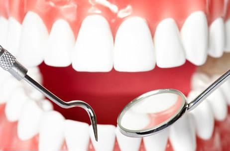 定期洗牙能有效预防牙周病