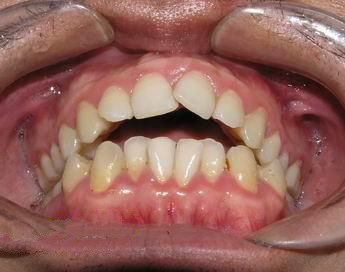 口腔畸形的特点是什么